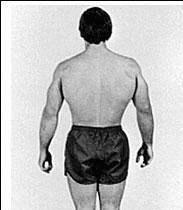 casey viator before - Joeri Zwart